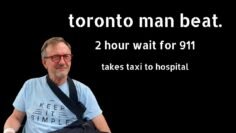 Toronto Man Beat- No Police Response For 2 Hours