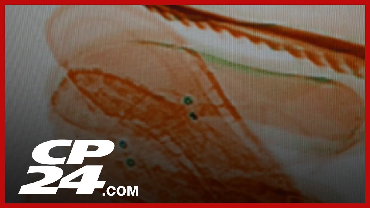 Assault outside Midland hotel sends man to hospital – content – WESHH